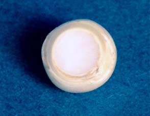 Sezione di una perla di coltura con nucleo. Evidenti i tipici strati di perlagione intorno al nucleo.