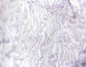 superficie tipica di perlagione a impronta digitale